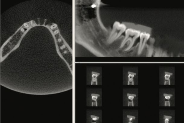 BEI ADENTICS | Parodontologie - Zahnhalteapparat (Parodont).